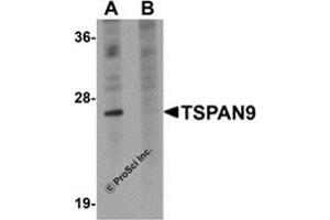 Western blot analysis of TSPAN9 in EL4 cell lysate with this product at 1 μg/ml in (A) the absence and (B) the presence of blocking peptide. (Tetraspanin 9 抗体  (Center))