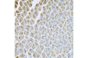 Immunohistochemistry (Paraffin-embedded Sections) (IHC (p)) image for anti-Adaptor-Related Protein Complex 1, mu 2 Subunit (AP1m2) (AA 164-423) antibody (ABIN6136948)