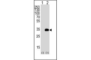 Western blot analysis of G5 (arrow) using rabbit polyclonal G5 Antibody 1812c. (ATG5 抗体)