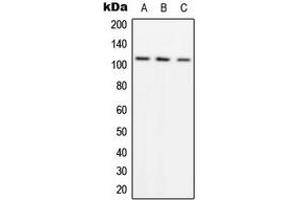 Western blot analysis of ADAMTS1 expression in A549 (A), SW480 (B), HeLa (C) whole cell lysates. (ADAMTS1 抗体  (Center))