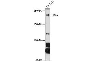 Western blot analysis of extracts of SH-SY5Y cells, using TSC2 antibody (ABIN6128542, ABIN6149611, ABIN6149612 and ABIN6213862) at 1:1000 dilution. (Tuberin 抗体  (AA 900-1150))