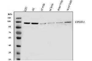Western blot analysis of Eph receptor B1 using anti-Eph receptor B1 antibody (ABIN3042375). (EPH Receptor B1 抗体  (N-Term))