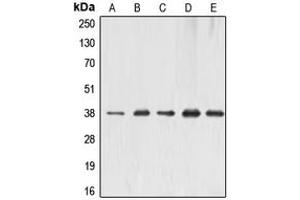 Western blot analysis of ERCC1 expression in MCF7 (A), HeLa (B), A431 (C), mouse liver (D), rat kidney (E) whole cell lysates. (ERCC1 抗体  (Center))
