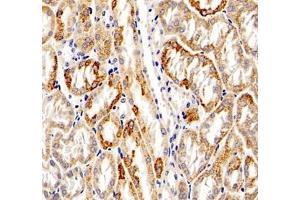 Immunohistochemistry (Paraffin-embedded Sections) (IHC (p)) image for anti-Aldehyde Dehydrogenase 4 Family, Member A1 (ALDH4A1) antibody (ABIN7073000)