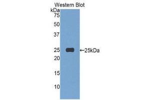 Western Blotting (WB) image for anti-Afamin (AFM) (AA 22-210) antibody (ABIN1857931)