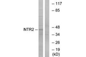 Western blot analysis of extracts from Jurkat cells, using NTR2 Antibody. (NTSR2 抗体  (AA 151-200))