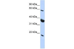 WB Suggested Anti-SRPR Antibody Titration:  0. (SRPR 抗体  (Middle Region))