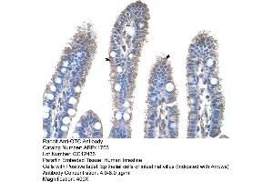 Rabbit Anti-OTC Antibody  Paraffin Embedded Tissue: Human Intestine Cellular Data: Epithelial cells of intestinal villas Antibody Concentration: 4. (OTC 抗体  (N-Term))