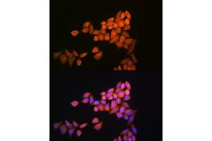 Immunofluorescence analysis of NIH-3T3 cells using Thioredoxin 1 (Trx1/Thioredoxin 1 (Trx1/TXN)) Rabbit pAb (ABIN6133954, ABIN6149719, ABIN6149721 and ABIN6213598) at dilution of 1:100 (40x lens). (TXN 抗体  (AA 1-100))