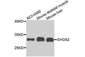 Western blot analysis of extracts of various cell lines, using SHOX2 antibody. (SHOX2 抗体  (AA 96-355))