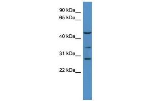 B3galt2 antibody used at 0. (B3GALT2 抗体  (C-Term))