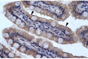 Human Intestine; SMPDL3B antibody - N-terminal region in Human Intestine cells using Immunohistochemistry (SMPDL3B 抗体  (N-Term))