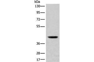 Western blot analysis of Mouse liver tissue lysate using USP12 Polyclonal Antibody at dilution of 1:700 (USP12 抗体)