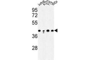 Western Blotting (WB) image for anti-Calcium Activated Nucleotidase 1 (CANT1) antibody (ABIN3003928) (CANT1 抗体)