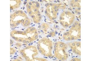 Immunohistochemistry of paraffin-embedded Human kidney using ELMO3 Polyclonal Antibody at dilution of 1:100 (40x lens). (ELMO3 抗体)