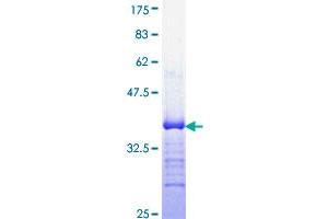 Image no. 1 for ERG, ETS transcription factor (ERG) (AA 1-100) protein (GST tag) (ABIN1353056)