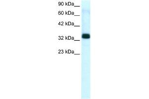 WB Suggested Anti-TIAL1 Antibody Titration:  1. (TIAL1 抗体  (C-Term))