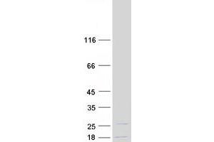 Validation with Western Blot
