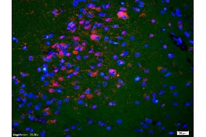 Formalin-fixed and paraffin-embedded rat brain labeled with Anti-KIF5A/NKHC1 Polyclonal Antibody, Unconjugated (ABIN1387674) 1:200, overnight at 4°C, The secondary antibody was Goat Anti-Rabbit IgG, Cy3 conjugated used at 1:200 dilution for 40 minutes at 37°C. (K5A/ NKHC1 (AA 201-300) 抗体)