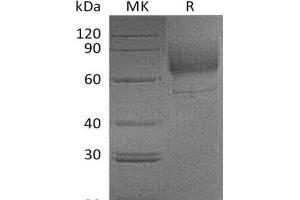 SCARB2 Protein (Fc Tag)