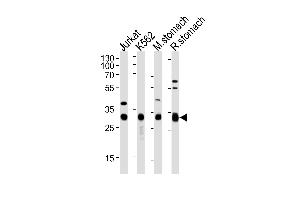 Western blot analysis of lysates from Jurkat, K562 cell line, mouse stomach and rat stomach tissue (from left to right), using ESD Antibody (Center) (ABIN1882167 and ABIN2838493). (Esterase D 抗体  (AA 68-102))