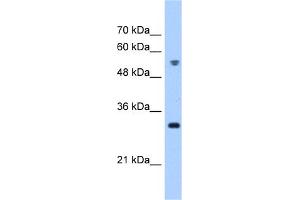 WB Suggested Anti-TTC5 Antibody Titration:  0. (TTC5 抗体  (C-Term))
