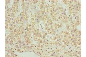 Immunohistochemistry of paraffin-embedded human adrenal gland tissue using ABIN7170079 at dilution of 1:100 (SLC12A4 抗体  (AA 601-900))