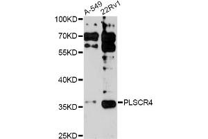 Western blot analysis of extracts of various cell lines, using PLSCR4 antibody (ABIN6291579) at 1:3000 dilution. (PLSCR4 抗体)