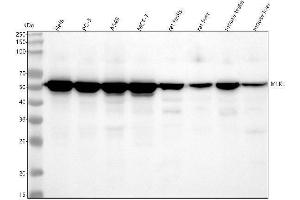 Western blot analysis of MLKL using anti-MLKL antibody (ABIN7605570).