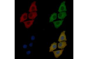 YTHDF3 Mouse Monoclonal Antibody staining Hela cells by IF/ICC. (YTHDF3 抗体)