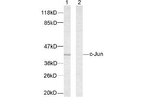 Western blot analysis of extracts from NIH/3T3 cells treated with UV. (C-JUN 抗体  (Ser63))