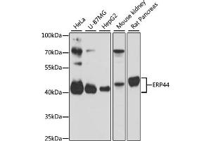 Western blot analysis of extracts of various cell lines, using ERP44 antibody (ABIN1679753, ABIN3019013, ABIN3019014 and ABIN6220673) at 1:3000 dilution. (ERP44 抗体  (AA 57-406))