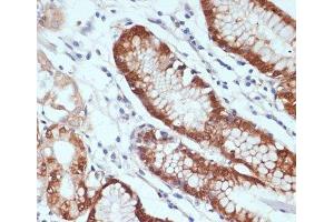 Immunohistochemistry (Paraffin-embedded Sections) (IHC (p)) image for anti-Chemokine (C-X-C Motif) Ligand 12 (CXCL12) antibody (ABIN7008123)