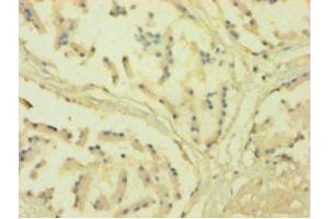 Immunohistochemistry of paraffin-embedded human prostate tissue using ABIN7161023 at dilution of 1:100 (POR 抗体  (AA 2-671))