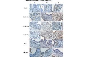 Immunohistochemistry (IHC) image for anti-Hydroxy-delta-5-Steroid Dehydrogenase, 3 beta- and Steroid delta-Isomerase 2 (HSD3B2) antibody (ABIN2855488)