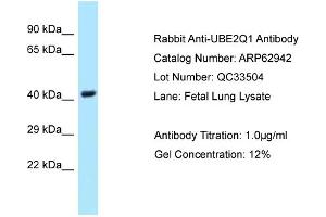 Western Blotting (WB) image for anti-Ubiquitin-Conjugating Enzyme E2Q Family Member 1 (UBE2Q1) (Middle Region) antibody (ABIN2789308) (UBE2Q1 抗体  (Middle Region))