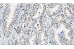 ABIN6276720 at 1/100 staining Human prostate tissue by IHC-P. (Phenylalanine Hydroxylase 抗体  (N-Term))