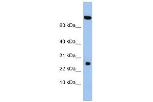 WB Suggested Anti-ZSWIM3 Antibody Titration: 0. (ZSWIM3 抗体  (N-Term))