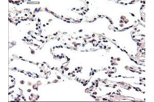 Immunohistochemical staining of paraffin-embedded lung using anti-FOXA2 (ABIN2452672) mouse monoclonal antibody. (FOXA2 抗体  (AA 300-458))