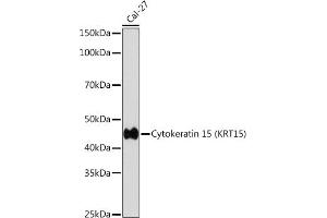 Western blot analysis of extracts of Cal-27 cells, using Cytokeratin 15 (KRT15) (KRT15) antibody (ABIN7268093) at 1:1000 dilution. (KRT15 抗体)