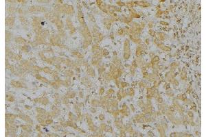 ABIN6272963 at 1/100 staining Mouse liver tissue by IHC-P. (LONP1 抗体  (C-Term))