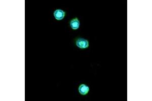 ICC/IF analysis of TLR7 in THP-1 cells line, stained with DAPI (Blue) for nucleus staining and monoclonal anti-human TLR7 antibody (1:100) with goat anti-mouse IgG-Alexa fluor 488 conjugate (Green). (TLR7 抗体)