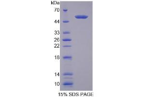 SDS-PAGE analysis of Mouse TDP1 Protein. (TDP1 蛋白)