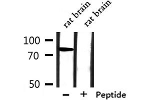Western blot analysis of extracts from rat brain, using SLC6A17 Antibody. (SLC6A17 抗体  (Internal Region))
