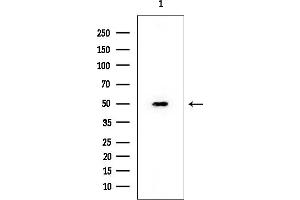 Western blot analysis of lysates from HUVEC cells, using MLKL Mouse Monoclonal Antibody at 1/1000 dilution.