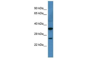 WB Suggested Anti-Cacng1 Antibody Titration: 0. (CACNG1 抗体  (N-Term))