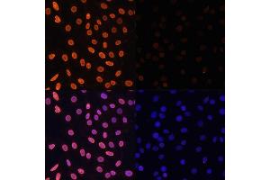 Immunofluorescence analysis of C6 cells using Acetyl-Histone H3-K36 antibody (ABIN7267671) at dilution of 1:100. (Histone 3 抗体  (H3K36))