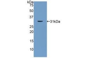 Detection of Recombinant PNMA2, Rat using Polyclonal Antibody to Paraneoplastic Antigen MA2 (PNMA2) (PNMA2 抗体  (AA 74-333))