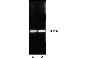 Western blot analysis of Proteasome 19S ATPase subunit Rpt6, mAb (p45-110) . (Proteasome 19S Rpt6/S8 Subunit 抗体)
