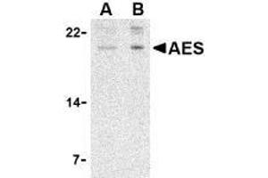 Western blot analysis of AES in 293 cell lysate with AES antibody at (A) 2 and (B) 4 μg/ml. (AES 抗体  (N-Term))